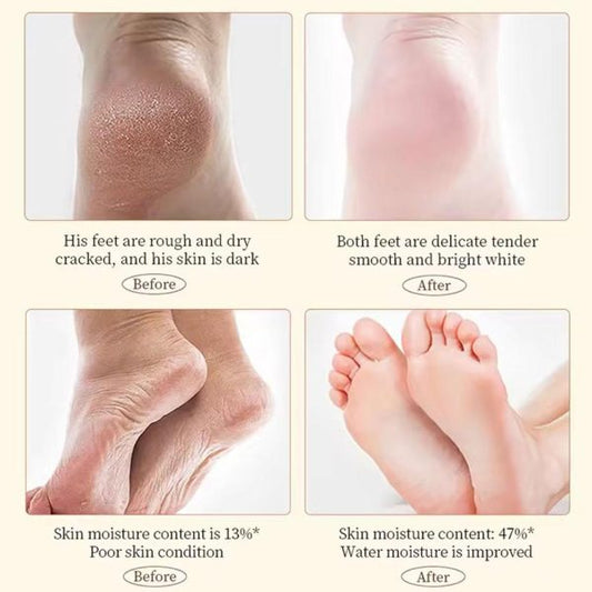 Foot Cream Moisturizing Calluses Dead Skin Repair Rehydration Soften Cuticle Smooth Restore Feet Care