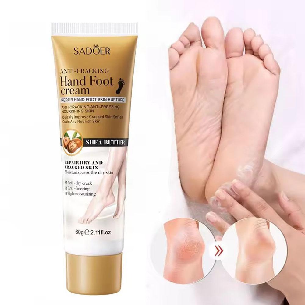 Foot Cream Moisturizing Calluses Dead Skin Repair Rehydration Soften Cuticle Smooth Restore Feet Care