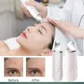 Rechargeable Ultrasonic Skin Scrubber _Facial Cleansing
