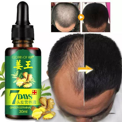 Original 7 Days Hair Growth Germinal Serum Oil (30ml)
