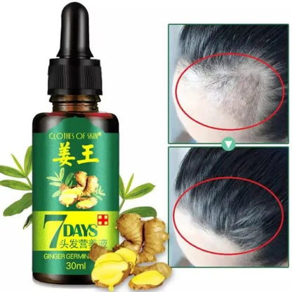 Original 7 Days Hair Growth Germinal Serum Oil (30ml)