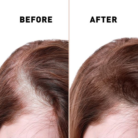 Anti Hair Fall Control Serum for Men & Women - Hair Growth Essence Oil Hair Care Serum
