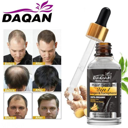 Anti Hair Fall Control Serum for Men & Women - Hair Growth Essence Oil Hair Care Serum