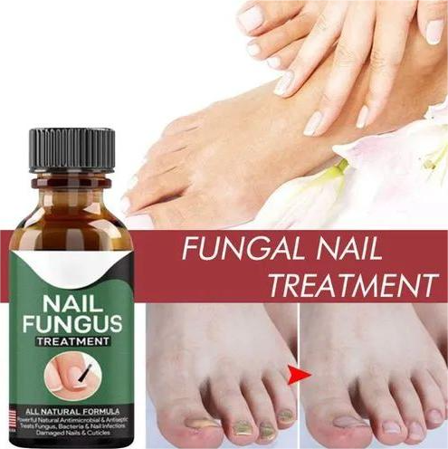 Fast Nail Fungal Treatments Nail Repair Essences Serum Care