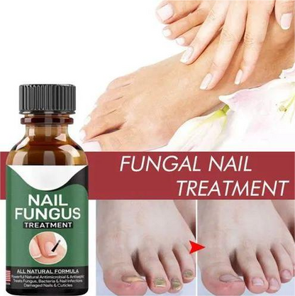 Fast Nail Fungal Treatments Nail Repair Essences Serum Care