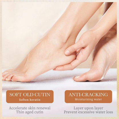Foot Cream Moisturizing Calluses Dead Skin Repair Rehydration Soften Cuticle Smooth Restore Feet Care