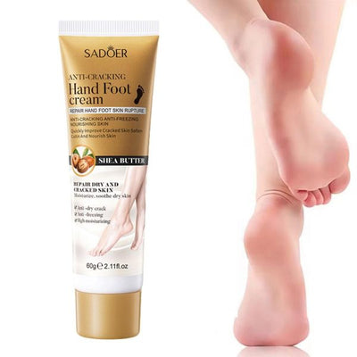 Foot Cream Moisturizing Calluses Dead Skin Repair Rehydration Soften Cuticle Smooth Restore Feet Care