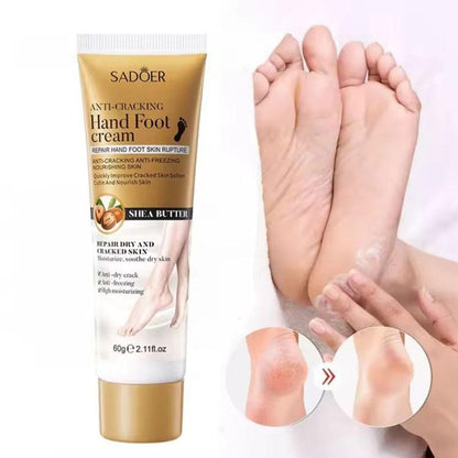 Foot Cream Moisturizing Calluses Dead Skin Repair Rehydration Soften Cuticle Smooth Restore Feet Care