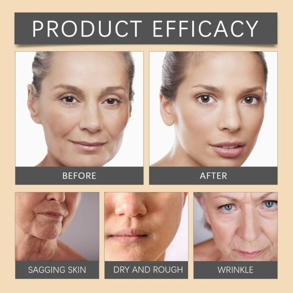 Bee Venom Face Cream – Whitening, Anti-Aging & Deep Moisturizing Skincare